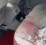 На рыбалке в Омской области парню оторвало ногу - СуперОмск