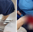 Зажевало конечность: 58-летняя жительница Новосибирска повредила руку в машине для раскатки теста. ФОТО - Om1.Ru