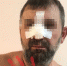 «Кидался на охрану и вырвал турникет»: в Омске охранники разбили нос посетителю во время вечеринки - Om1.Ru
