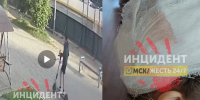 Омские следователи начали проверку сообщения о сбитой самокатчиком девочки - Комсомольская Правда