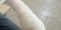 В Омске владельца стаффордширского терьера обязали выплатить 300 тысяч рублей за нападение собаки на школьницу - ИА Омскрегион